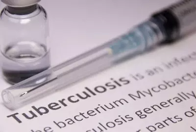 India accounts for 26 pc of global TB burden, the highest: WHO