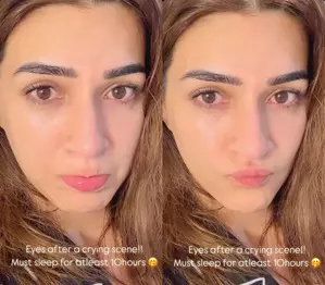 Kriti Sanon shares pictures of eyes post crying scene, needs 10 hours  of sleep