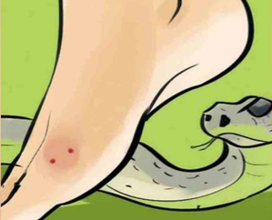 Centre declares snakebites a notifiable disease in India