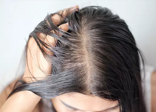 Get rid of hair fall problems in winter season; know these home remedies